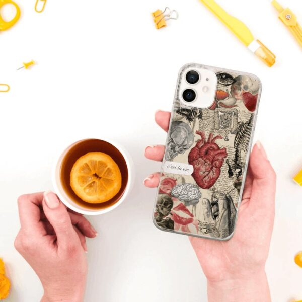 Medical illustration Phone Case Anatomy courses Cover for Pixel 8 Pro 7A, iPhone 15 14 13 12 Pro 11 XR for Samsung S24 FE S23 A73 A53 - Image 9